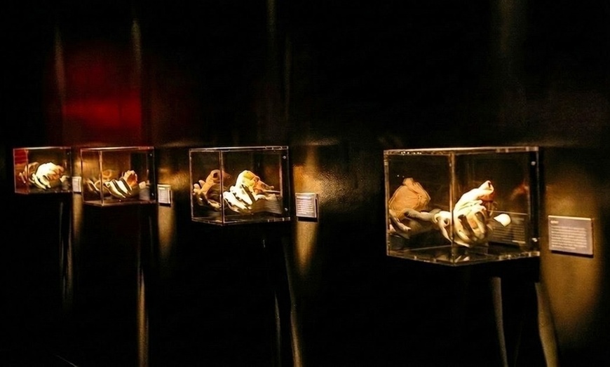 Image 3: REAL BODIES at Horseshoe Las Vegas – Discover the Human Body Like Never Before 
