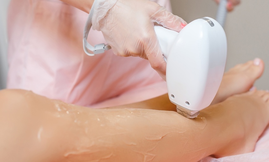 Image 2: Achieve Smoother Skin with Six Diode Laser Hair Removal Sessions