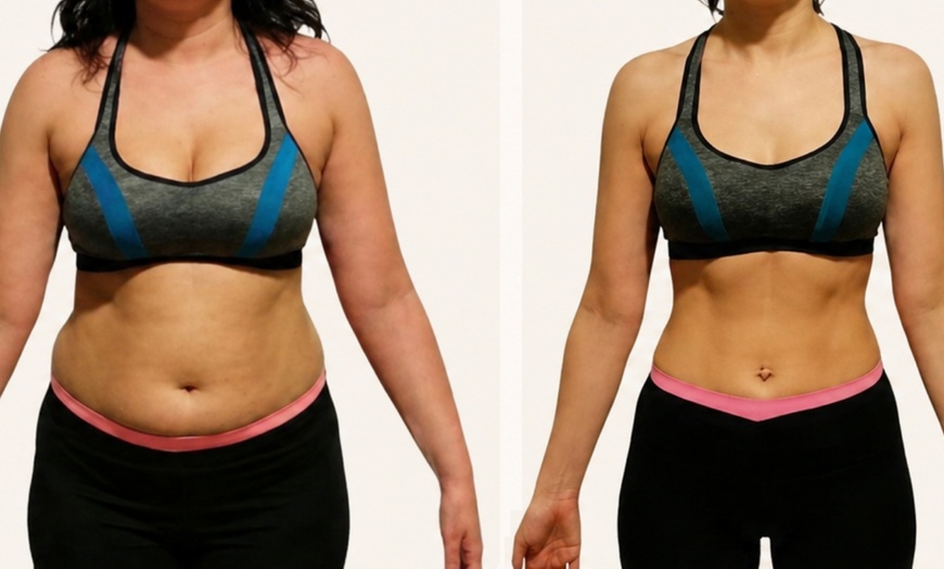 Image 7: Emerald Laser Total Body Fat Loss at Your Sculpt Studio DC