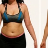 Image 7: Emerald Laser Total Body Fat Loss at Your Sculpt Studio DC