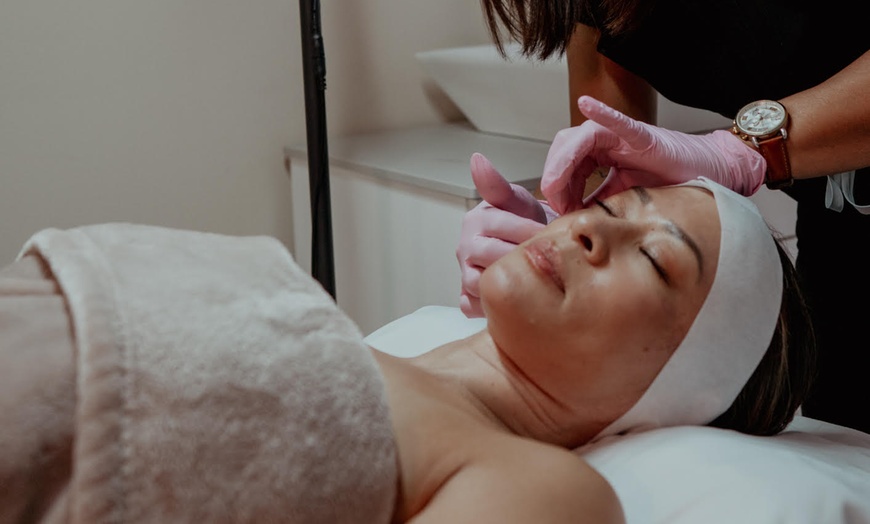 Image 4: CO2 Laser Skin Resurfacing for Wrinkles and Scars
