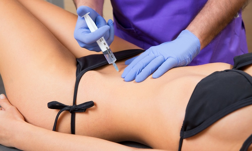 Image 6: Colombian Body Sculpting: Slim & Smooth with Up to 4 Powerful Sessions