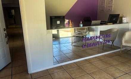 Acupuncture session for stress, anxiety or digestive system - Acupuncture and Beauty Spa