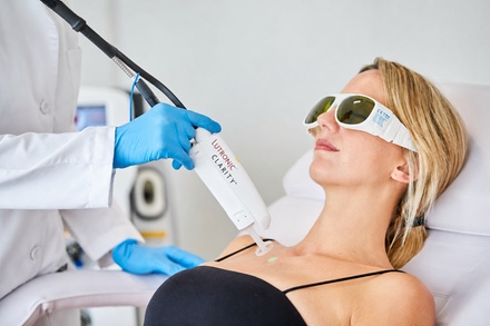 4 Upper lip & Chin Laser Hair Reduction - Skinholic Aesthetics And Laser