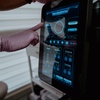 Image 3: CO2 Laser Skin Resurfacing for Wrinkles and Scars