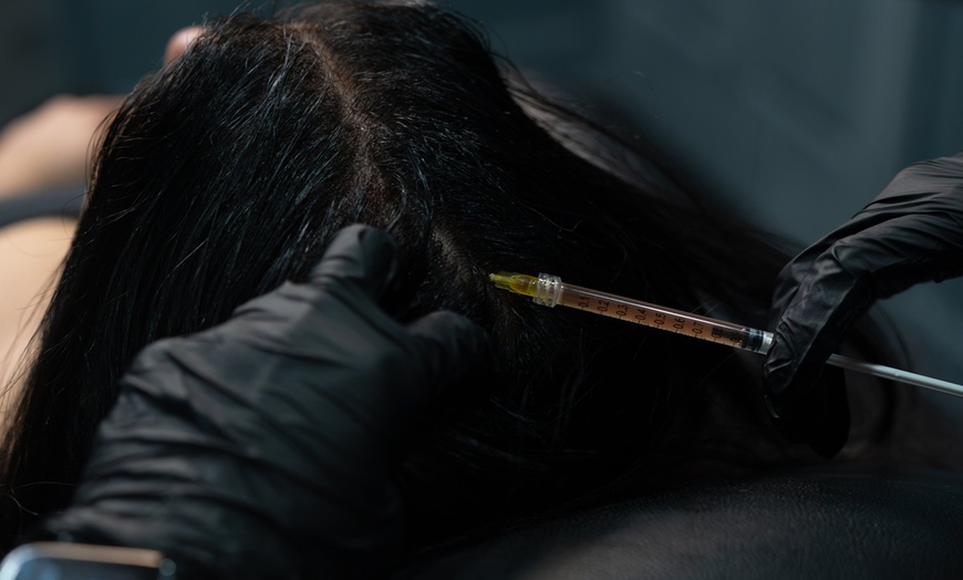 Image 7: PRP Hair Restoration for Full Head, Crown, or Hairline 