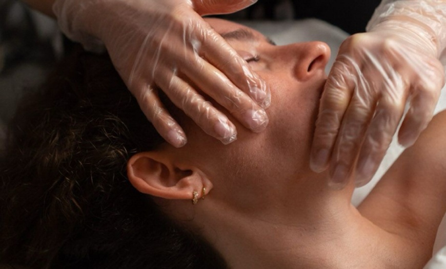 Image 2: Up to 39% Off on Chemical Peel at Aevua