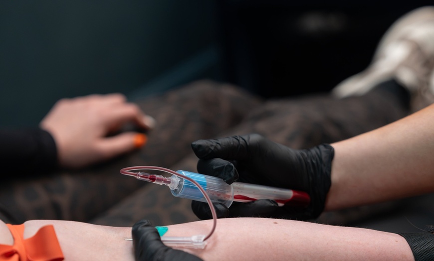 Image 5: PRP Hair Restoration for Full Head, Crown, or Hairline 