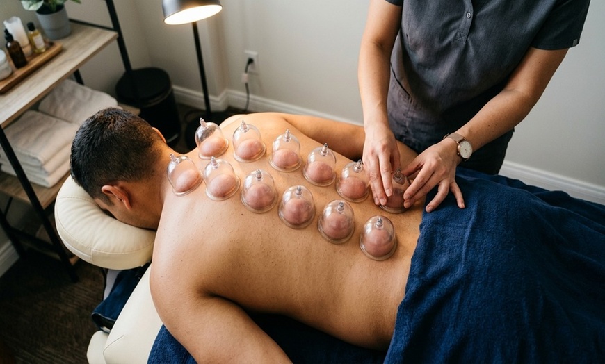 Image 7: Experience Full Body Massage with Fire Cupping and Hot Stones