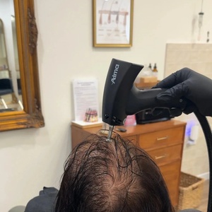 Scalp Analysis and Head Spa Package - Hairloom Wellness