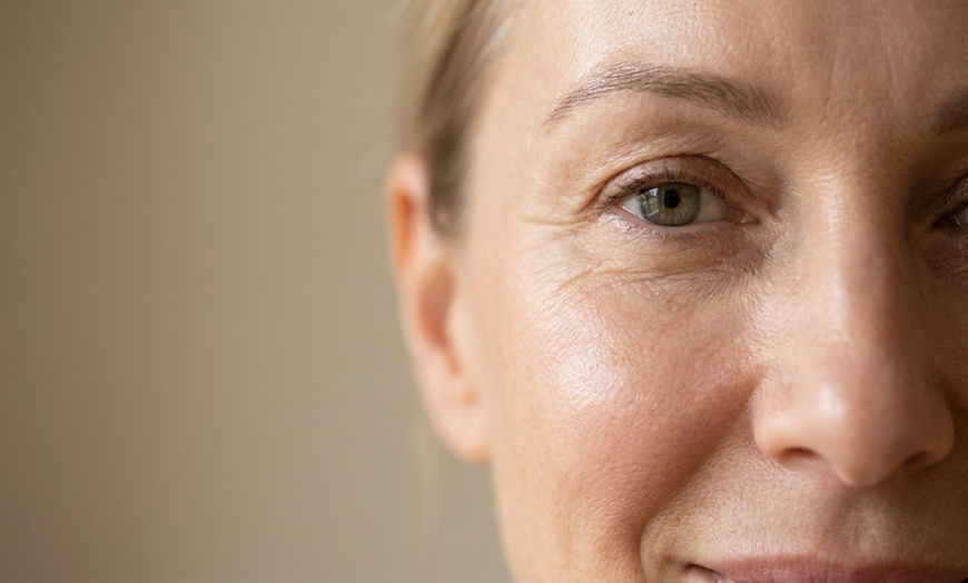 Image 4: Up to 76% Off on Facelift - Non-Surgical at Santorini Spa Llc