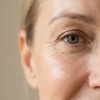Image 4: Up to 76% Off on Facelift - Non-Surgical at Santorini Spa Llc