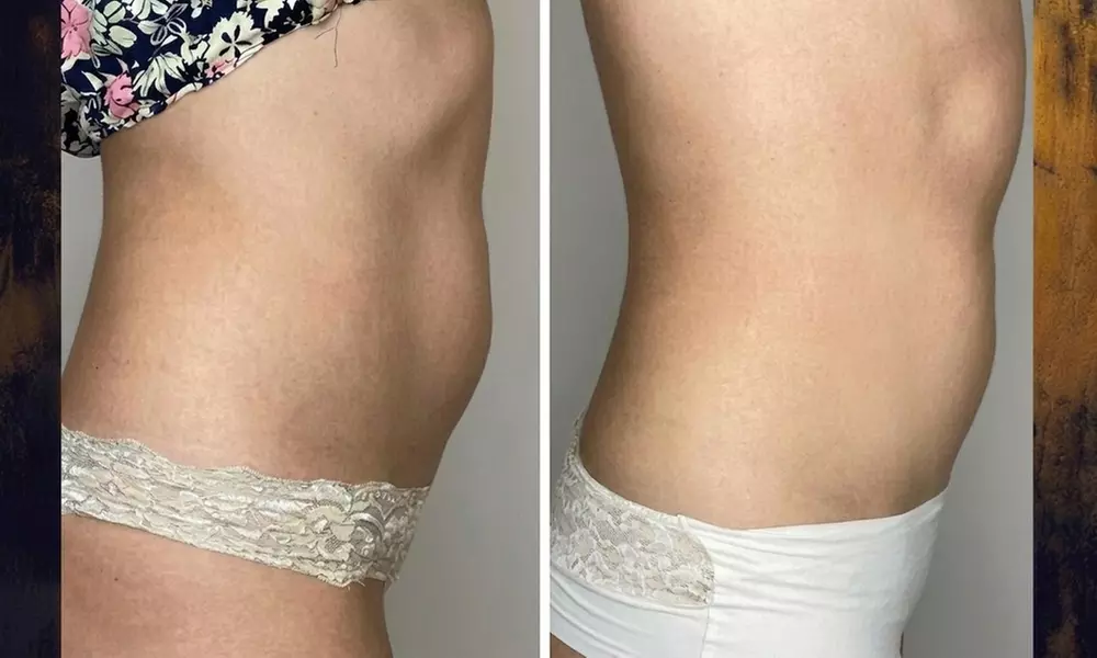 Modelowanie sylwetki i detoks: EMS, sauna IR, presoterapia (3 w 1)