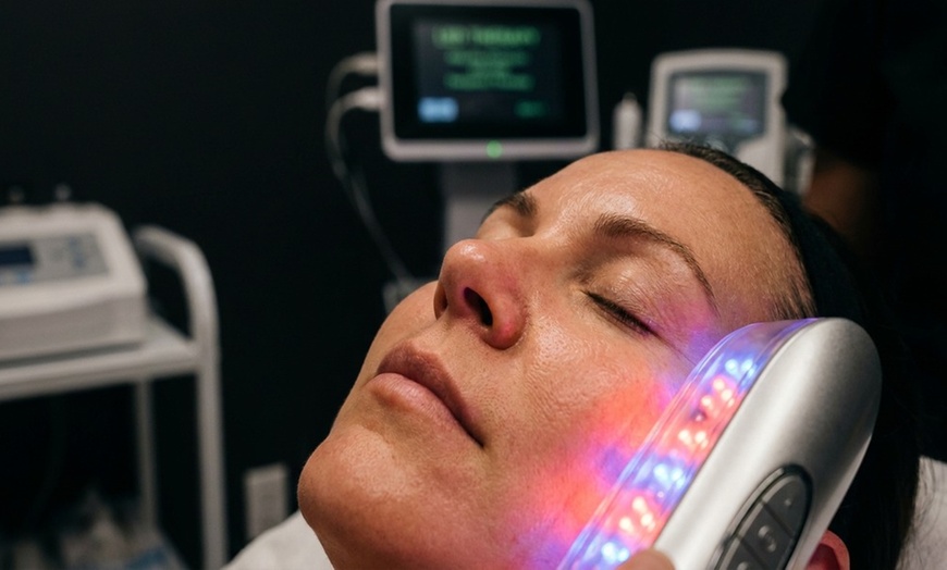 Image 7: Flawless Skin with Skin Tags, Sun Spots, Age Spots, or Milias Removal 