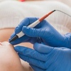 Image 1: 15- or 30-Minute Electrolysis Sessions for Hair Reduction
