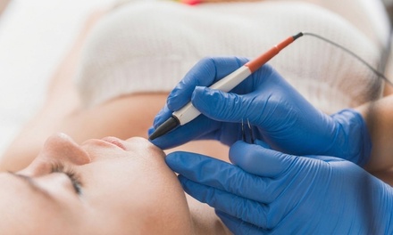 One 15-minute Electrolysis Session - Derinsu Beauty