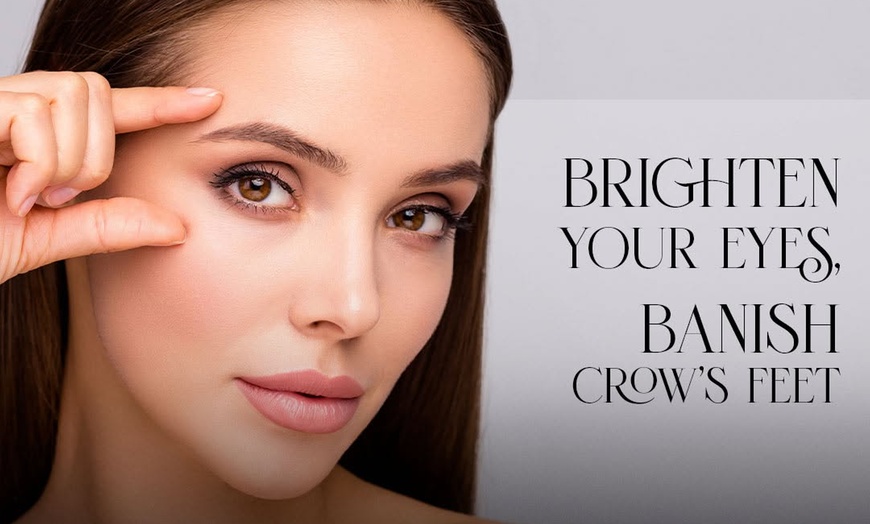 Image 4: Rejuvenate Your Look with 20, 40, or 60 Units of Botox