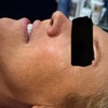 Image 2: Achieve Radiant Skin with IPL Photofacial Light Therapy