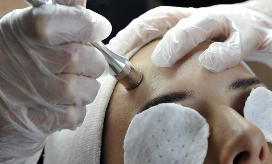 Image 3: Up to 39% Off on Chemical Peel at Aevua