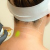 Image 2: Discover Laser Hair Removal at SEV Laser, a Celebrity-Favorite Salon  