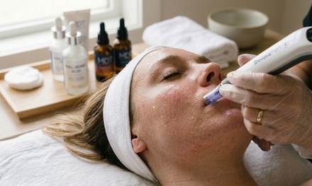 One Micro-Needling Treatment with PDRN - Omni Plastic Surgery Seattle