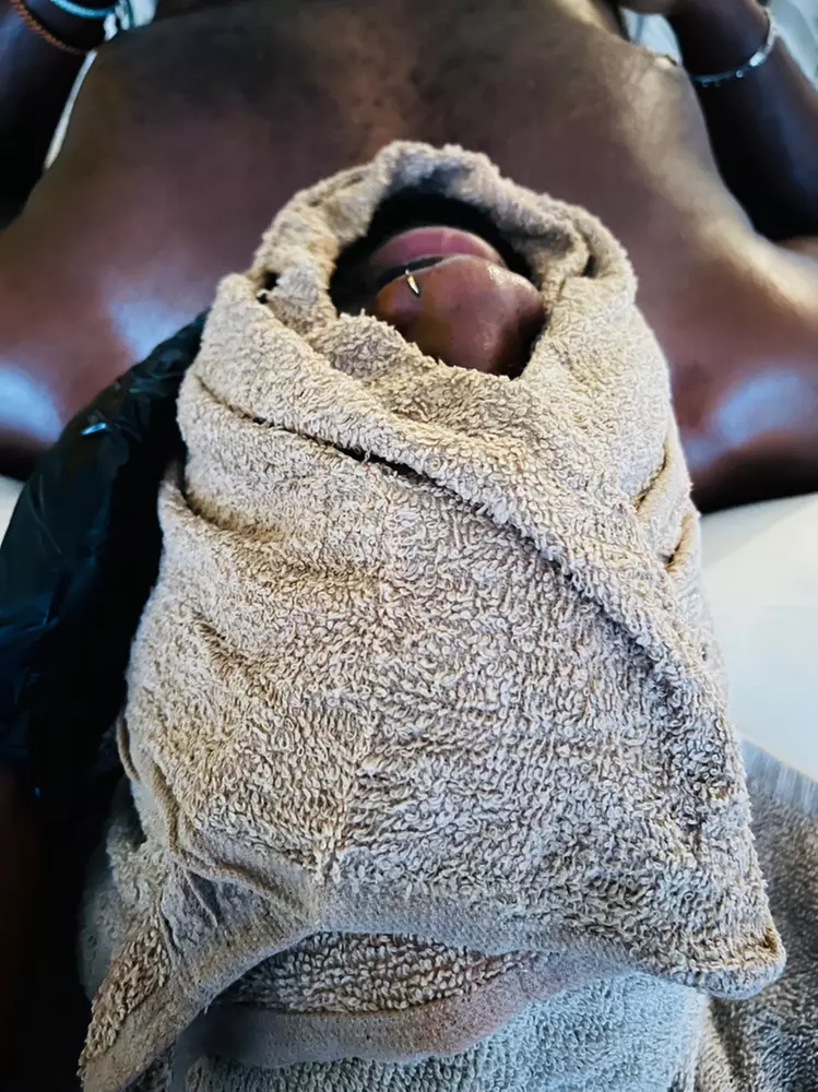 Anti-Aging Facial Sessions for Smoother, Youthful-Looking Skin