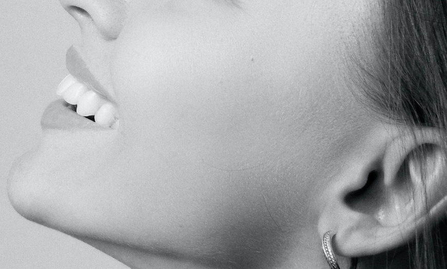 Image 6: 20, 40, or 60 Units of Botox for Fine Lines & Full-Face Refresh