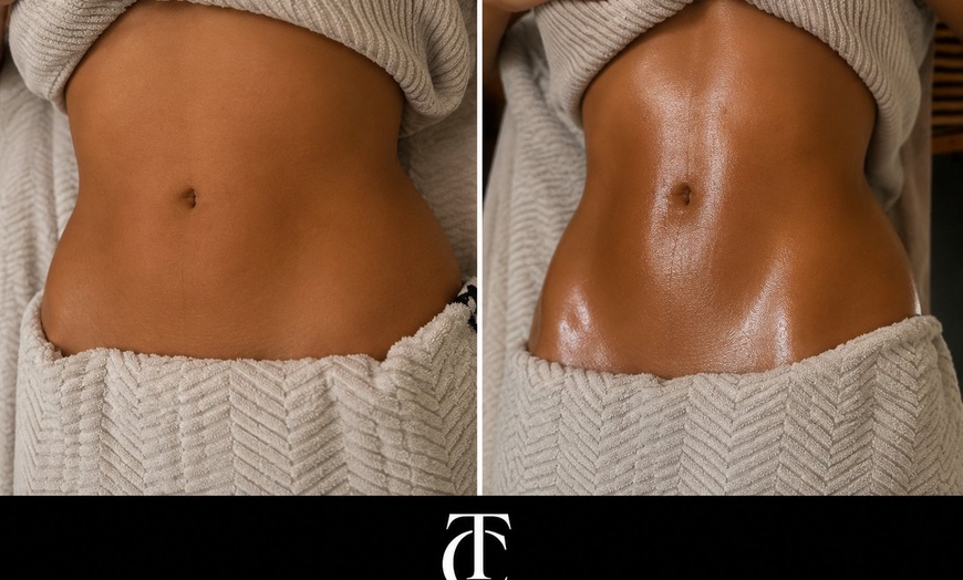 Image 2: Contouring Lymphatic Drainage Massages with Madero Therapy