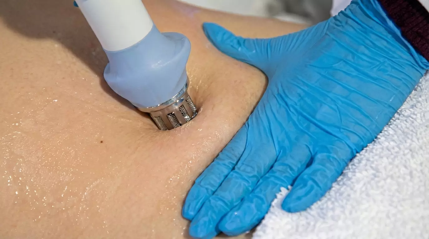 3, 6 o 9 sesiones de cavitación con radiofrecuencia y presoterapia