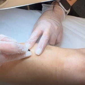 One 30-Minute Electrolysis Hair Removal Session - La Belle Studio by Soraya