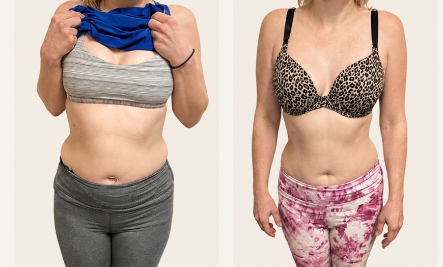 Image 2: Emerald Laser Total Body Fat Loss at Your Sculpt Studio DC