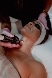 CO2 Laser Skin Resurfacing Face One Session - GoWell Med Spa