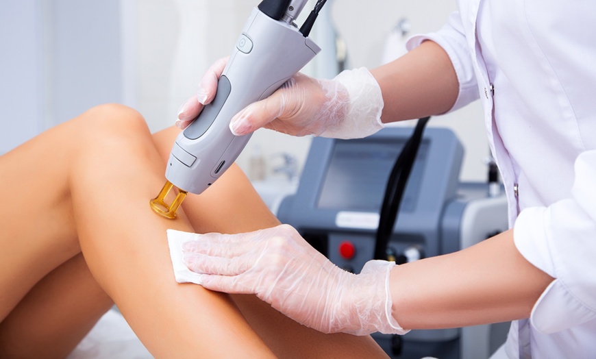 Image 2: 8 Sessions Laser Hair Removal for Various Areas at Lotus Health & Aesthetics: Red Bank