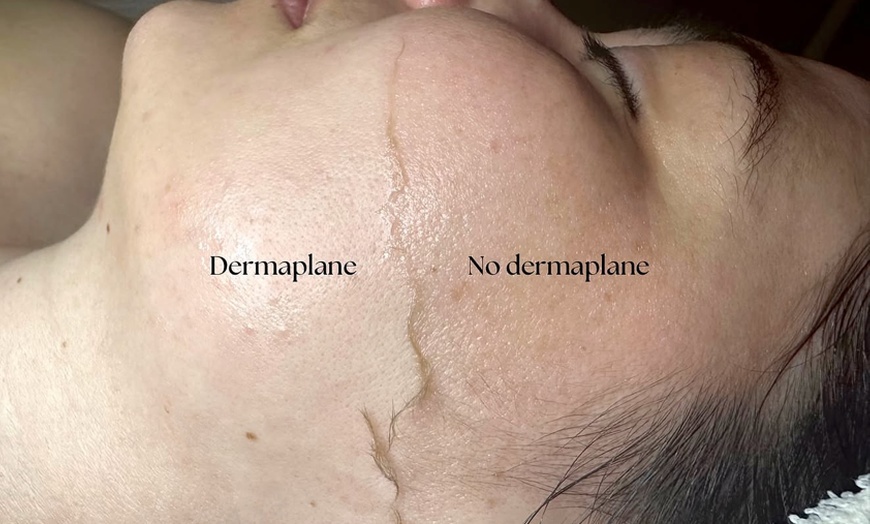 Image 2: Revitalizing Lymphatic Massage & Facial for Radiant Skin