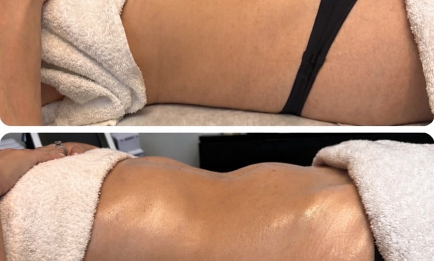 Image 3: Relax with 60-Minute Lymphatic Drainage: Choose 1, 3, or 5 Sessions