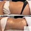 Image 3: Relax with 60-Minute Lymphatic Drainage: Choose 1, 3, or 5 Sessions