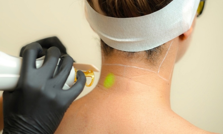 Image 2: Tailored Laser Hair Removal at SEV Laser, a Celebrity-Favorite Salon  