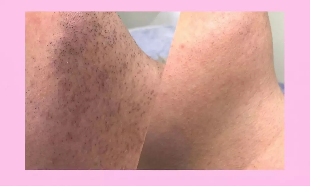 Beauty Factory Spa - From $50 - New York | Groupon