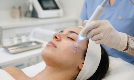 One Acne Treatment Session - Royal treatment spa Llc