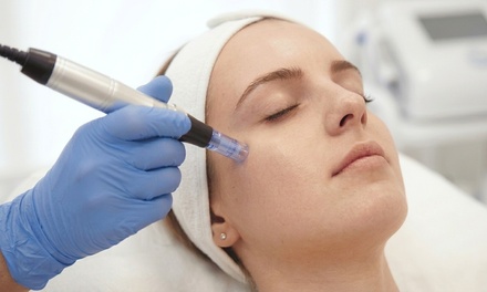 1 Microneedling Skin Rejuvenation Treatment; Valid Thursdays and Fridays Only - Truwellness Charlotte