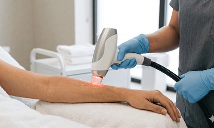 6 Laser Hair Removal Sessions on One Small Area - ElenaBeaute