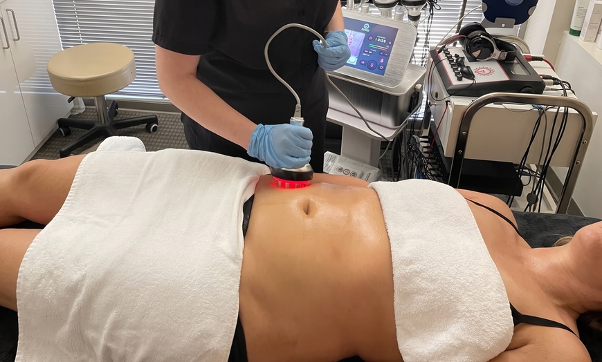 Image 3: Ultrasonic Cavitation & Radio Frequency Skin Tightening