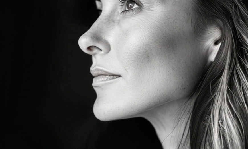 Image 6: Experience rejuvenation with one vial of Sculptra
