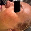 Image 3: Achieve Radiant Skin with IPL Photofacial Light Therapy