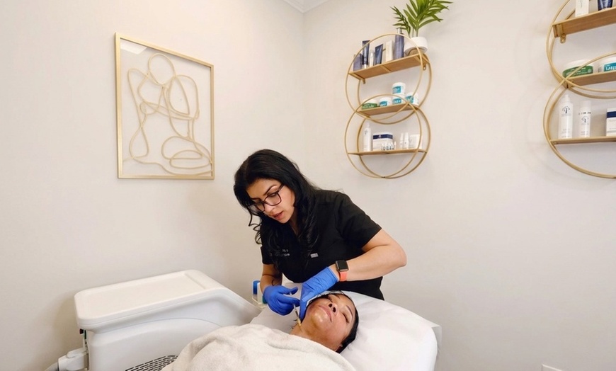 Image 2: PRF/PRP for Face, Under Eye, or Hair Restoration at Stay Ageless