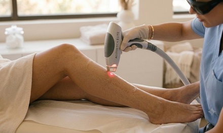 1 Laser Hair Removal  Sessions on One Small Area - Reviva Hair & Skin Clinic