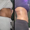 Image 3: Sculpted Curves & Revitalized Feel with Body Contouring Treatments