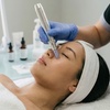 Image 1: Micro-Needling for Skin Rejuvenation & Collagen Boost