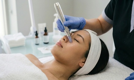 One Micro-Needling Treatment - Stem And Soma