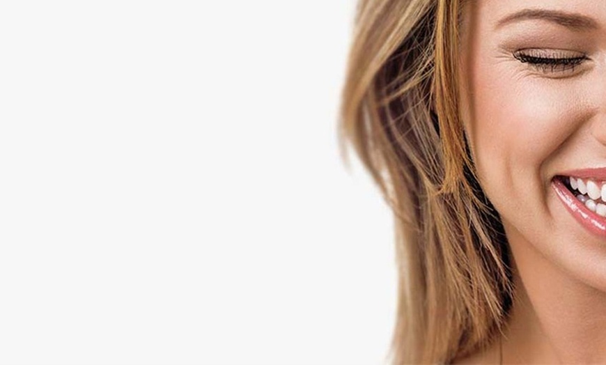 Image 4: Brighten Your Smile: Touch Up or Full-Service Teeth Whitening Session